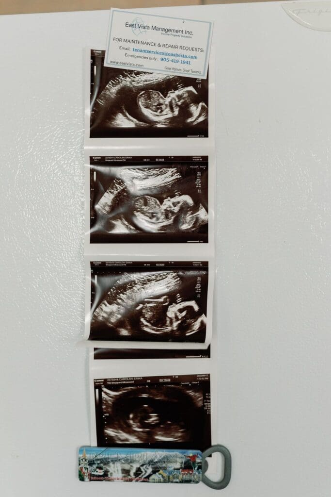 A strip of baby ultrasound images clipped to the refrigerator door